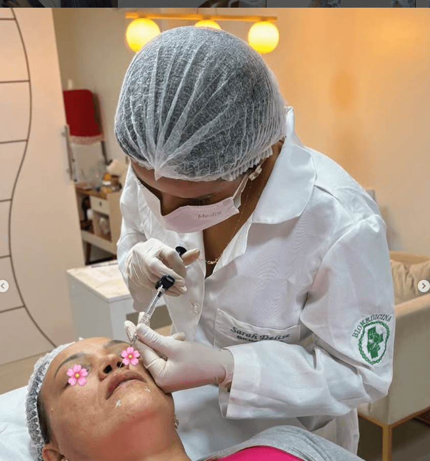 Bioestimulador — Colágeno